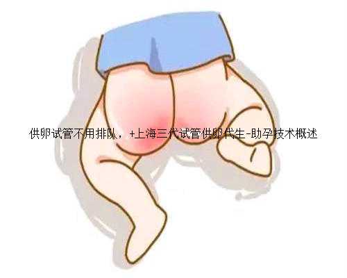 供卵试管不用排队， 上海三代试管供卵代生-助孕技术概述