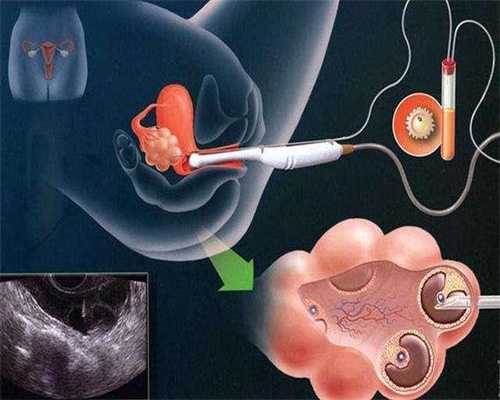 取出胚胎代孕：异性交往时，别管男人要这些东