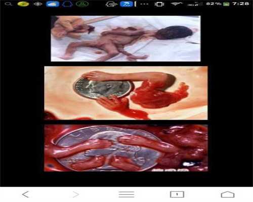 代孕产子血型：代孕期间，胎儿什么时候发育最