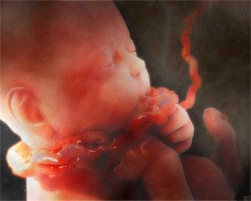 正规代孕医院：ACOG指南多胎妊娠双胎，三胎及高
