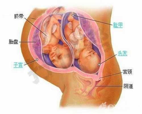 佛山鑫泰福康助孕：无睾症的治疗方法有哪些