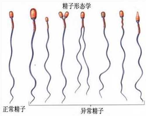 输卵管不孕的原因都是什么