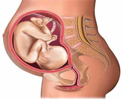 佛山代孕经历：女性多囊卵巢会造成不孕吗