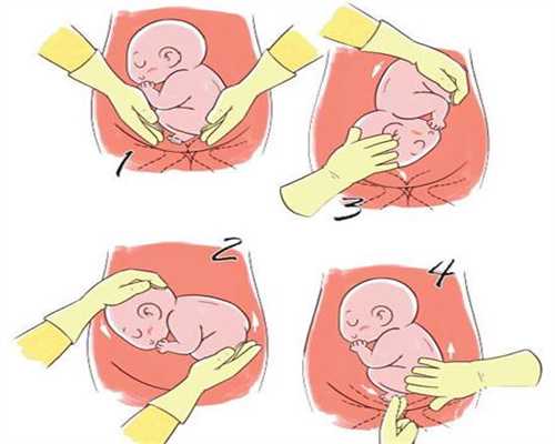 佛山代孕过程需要多久：34周b超胎儿头围偏小怎